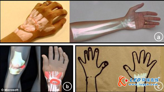 微软公司开发手持X射线仪 直接透视皮肤