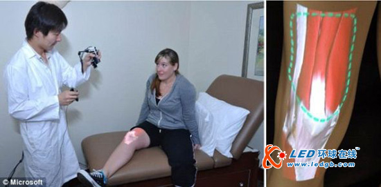 微软公司开发手持X射线仪 直接透视皮肤