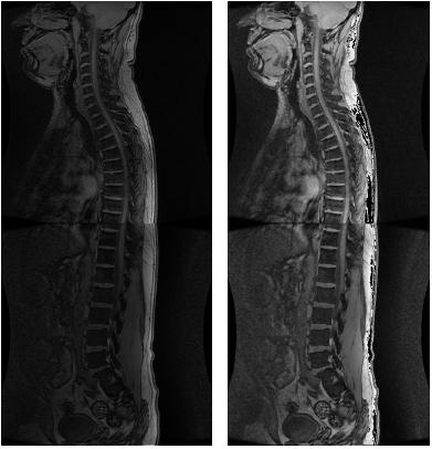 基于niosii的mri脊柱图像分割系统,解决方案