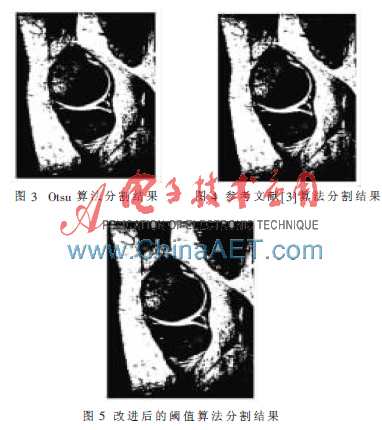 图像分割在医学图像处理中的应用研究,解决方