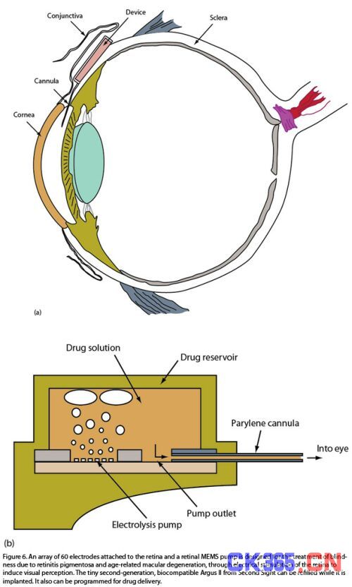 MEMS技术将迎来新的机遇与挑战,解决方案--华强电子网