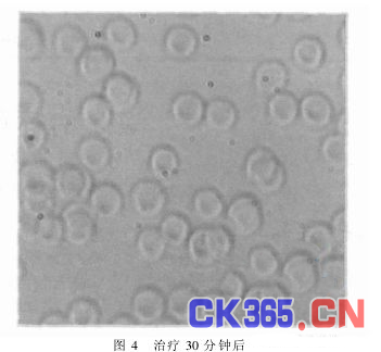 腕表式弱激光血管外照射治疗仪的研制,解决方