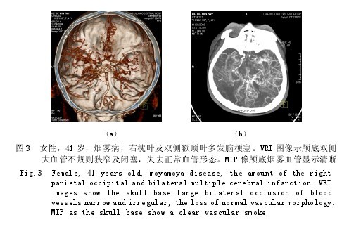 20130407042433098353910.jpg