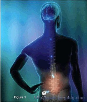 影像由圣犹达医疗用品公司供